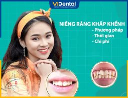 niềng răng khấp khểnh