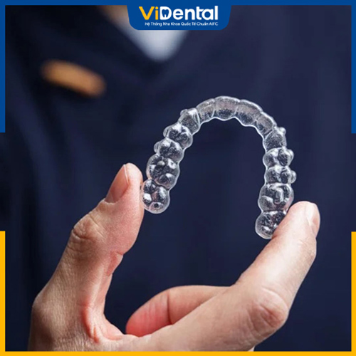 Niềng răng trong suốt Invisalign có chi phí khá cao