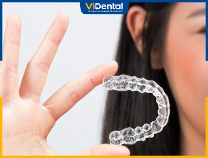 ưu nhược điểm của niềng răng Niềng răng Invisalign